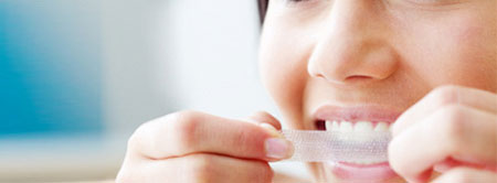 Teeth whitening products 