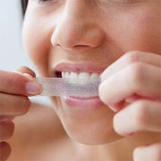 Teeth whitening that works