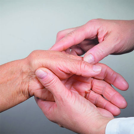 Is there A Cure for Rheumatoid Arthritis?