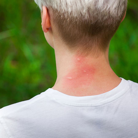 tabard does repel mosquitoes